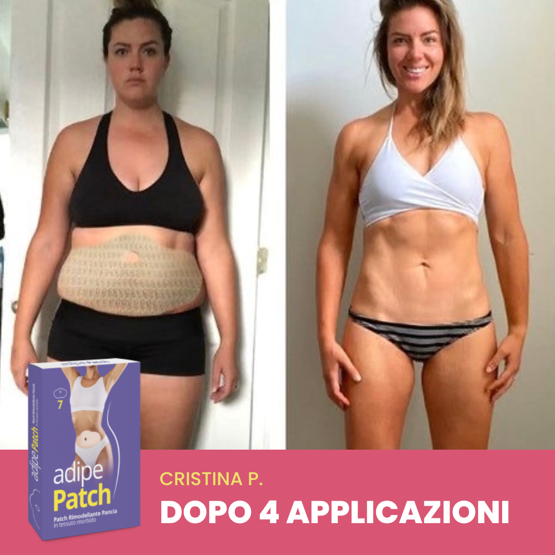 Risultati ADIPE PATCH addome