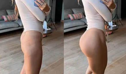 Trattamento rassodante glutei