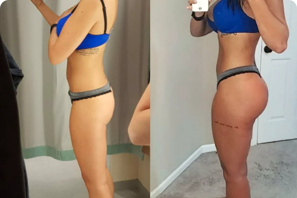 Risultato CULOTTE glutei