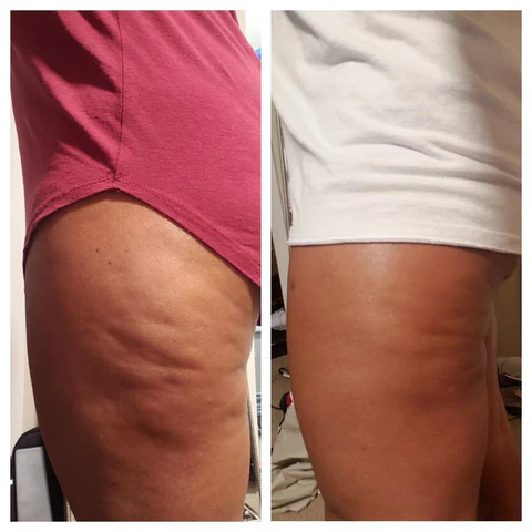 Risultati con Fango Cell Plus anticellulite