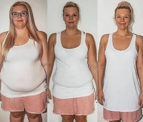 Risultato prima e dopo Xenadryl